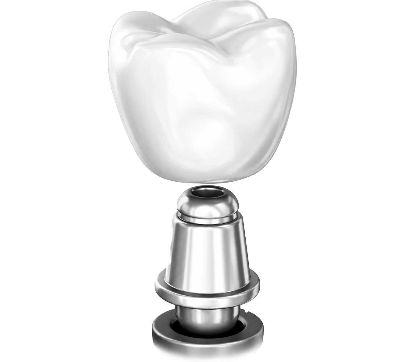 3D dental implant and crown render